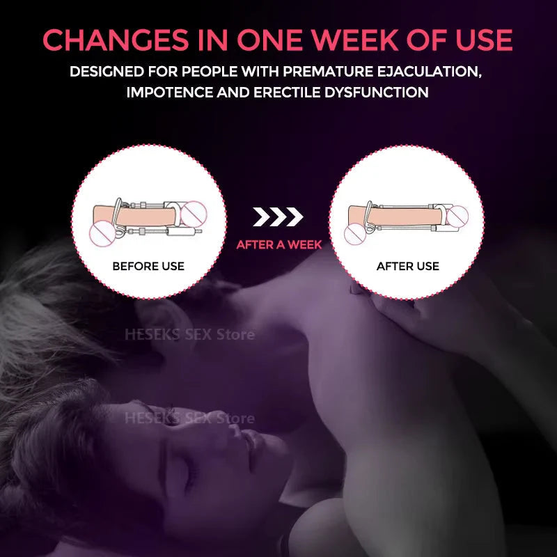 Penile Traction Device Adjustable Tension Stainless Steel & Silicone