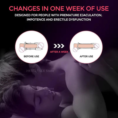 Penile Traction Device Adjustable Tension Stainless Steel & Silicone