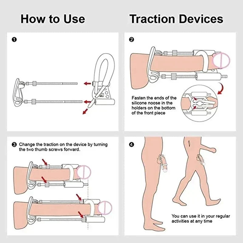 Penile Traction Device Adjustable Tension Stainless Steel & Silicone